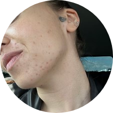 PROBLEMATICKÁ PLEŤ